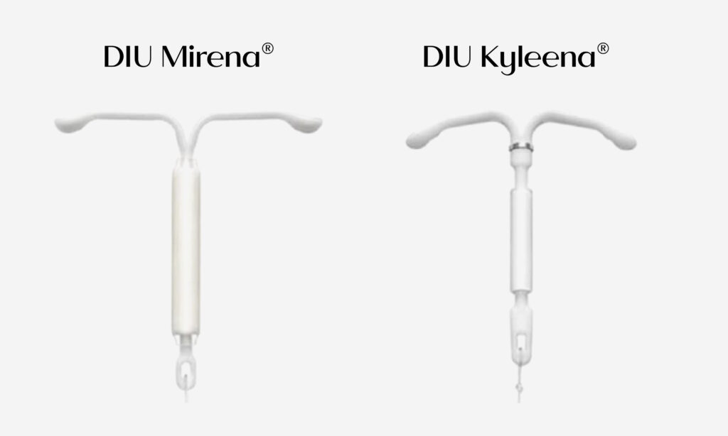 O que é DIU e como funciona? 2 Ilustração comparativa dos DIUs hormonais Mirena e Kyleena, métodos contraceptivos intrauterinos com liberação de hormônio.