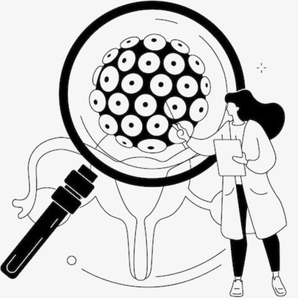 HPV positivo: o que significa e como lidar com esse diagnóstico? 1 Ilustração mostrando o colo do útero ampliado por uma lupa, com células em destaque e médica ao lado. Representação do HPV e suas alterações celulares.
